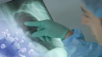 Angka Sembuh Covid-19 Secara Nasional Mencapai 136.401 Kasus