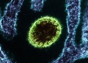 Nipah 72 Jam: Pertarungan Awal Pasien