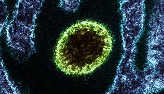 72 Jam Pertama Infeksi Nipah: Apa yang Terjadi?